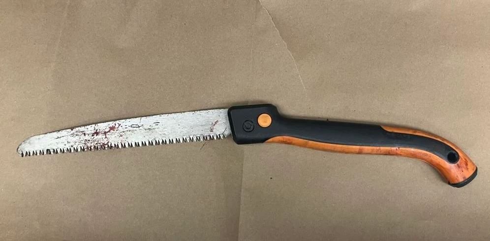 <i>Madison Police Department/WKOW via CNN Newsource</i><br/>A woman in Madison was attacked with a pruning saw during a fight Monday night