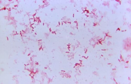 Plague is caused by the bacterium Yersinia pestis.
