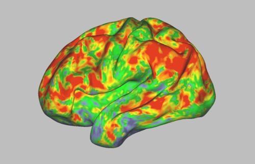 This brain on psilocybin is at the peak of activity
