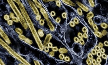 Four more health-care workers say they had respiratory symptoms after they tended to a hospitalized patient in Missouri who tested positive for H5N1 bird flu.