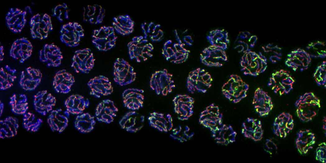 Developing eggs, where BRCA1 (green) is responding to DNA repair along chromosomes (red and blue).