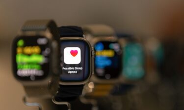 Your Apple Watch may be able to alert you to sleep apnea. Here's what it means if you get that notification and what you should do next.