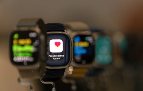 Your Apple Watch may be able to alert you to sleep apnea. Here's what it means if you get that notification and what you should do next.