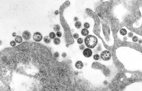 A resident of eastern Iowa who had recently traveled to West Africa died after catching Lassa fever