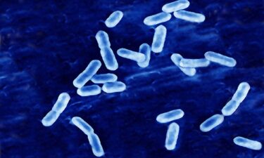 Listeria causes listeriosis