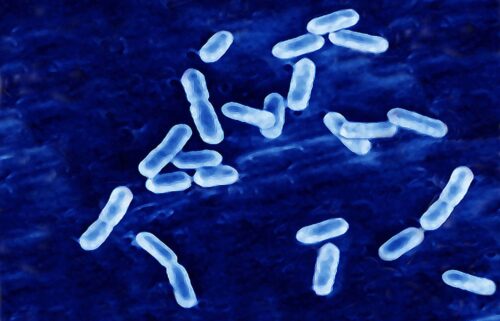 Listeria causes listeriosis