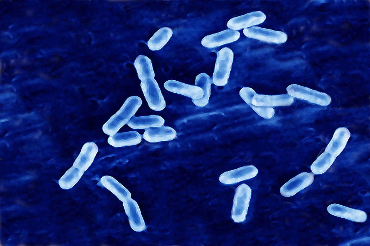 <i>BSIP/UIG/Getty Images via CNN Newsource</i><br/>Listeria causes listeriosis