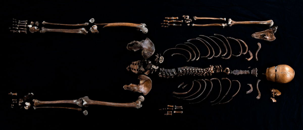 <i>Åge Hojem NTNU Vitenskapsmuseet via CNN Newsource</i><br/>Multiple excavations have helped researchers piece together Well-man's skeleton.