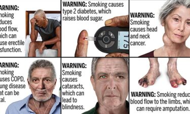 Examples of graphic public health warnings for cigarette packs