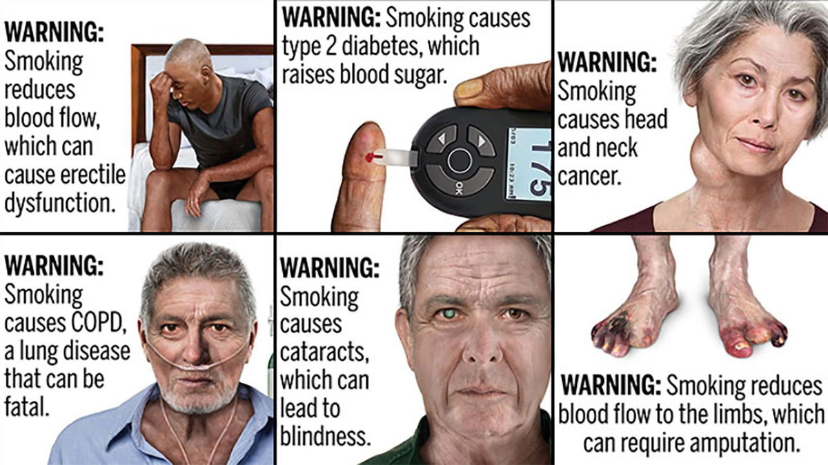 <i>US Food and Drug Administration via CNN Newsource</i><br/>Examples of graphic public health warnings for cigarette packs