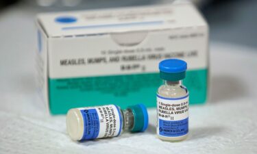 Measles is debilitating