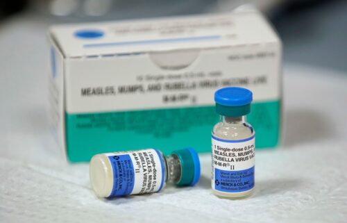 Measles is debilitating