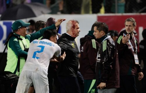 Javier Aguirre sustained a head injury after he was hit by a can thrown from the stands.