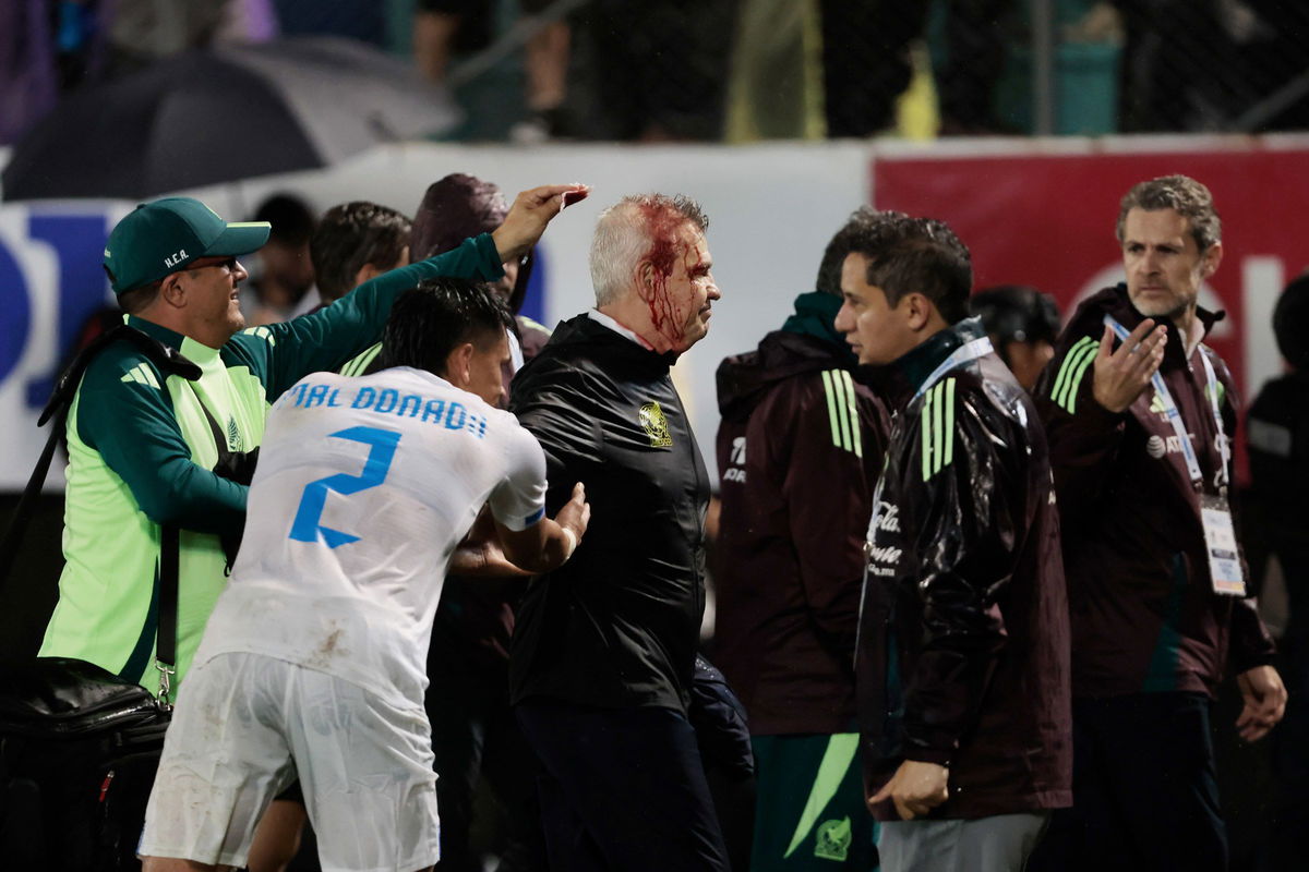 <i>Jorge Salvador Cabrera/Getty Images via CNN Newsource</i><br/>Javier Aguirre sustained a head injury after he was hit by a can thrown from the stands.