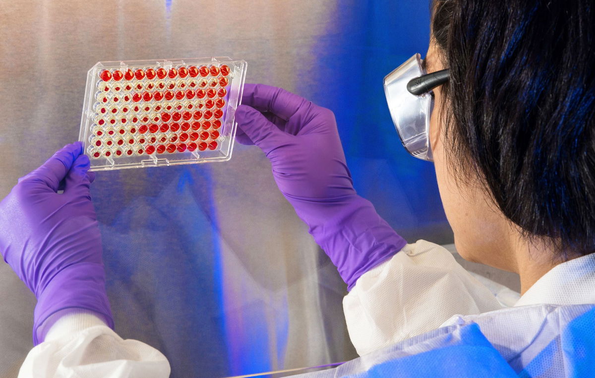 <i>LPN/Image Point Fr/BSIP/Universal Images Group/Getty Images via CNN Newsource</i><br/>Firings since February 14 have exceeded 700 each at the CDC and the FDA and 1