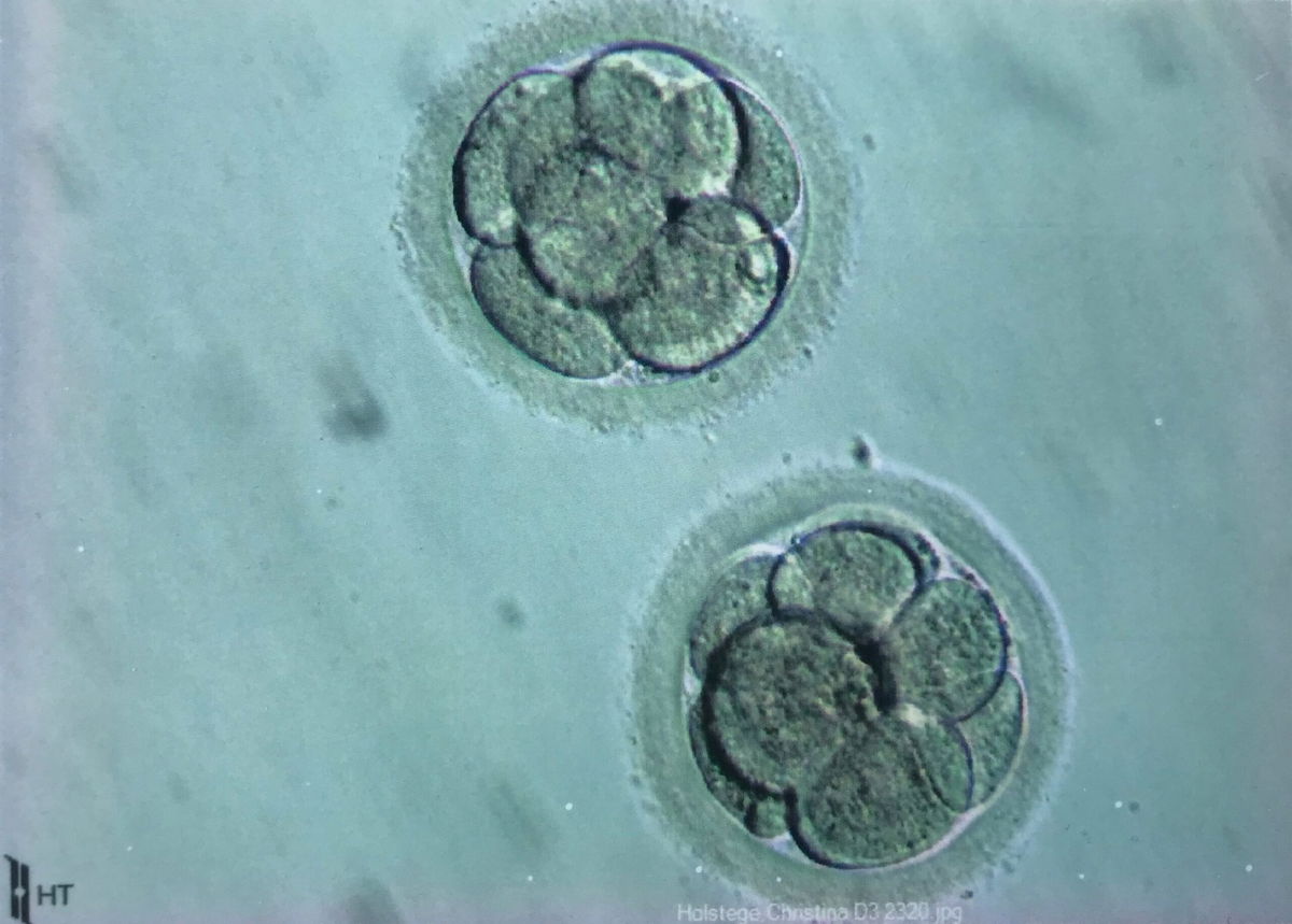 <i>Courtesy Christy Holstege via CNN Newsource</i><br/>Embryos belonging to Christy Holstege are stored in an American Reproductive Centers clinic.