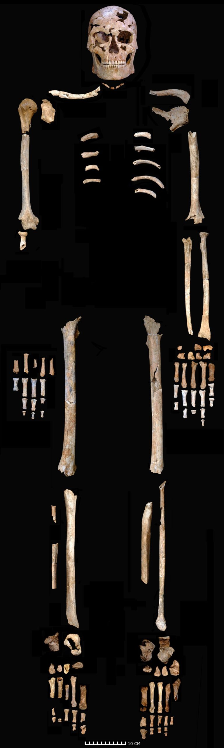 <i>C.M. Stimpson/A. Wilshaw/Stimpson et al. 2025 Proceedings of the Royal Society B via CNN Newsource</i><br/>The skull and skeleton of the man from the Thung Binh 1 cave are arranged in their anatomical positions.